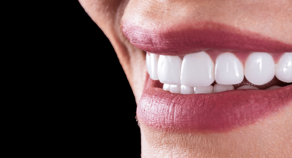 cosmetic porcelain veneers anchorage - Veneers in Anchorage