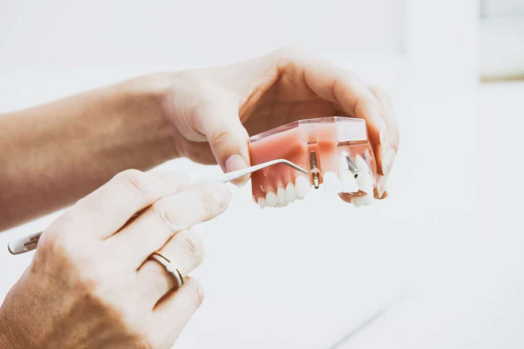 Dental Implants in Anchorage 2