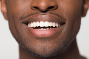 Denture Repairs in Anchorage