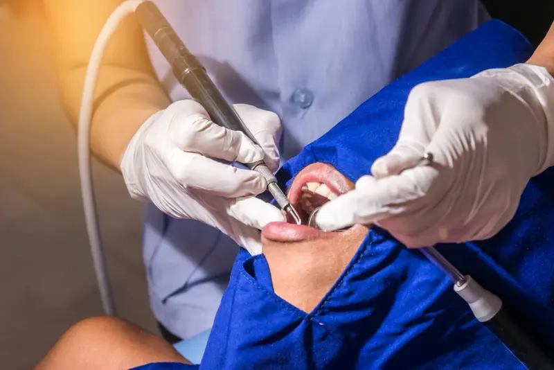 Fluoride Treatments for Adults