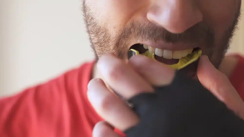 The Importance of Mouthguards in Sports