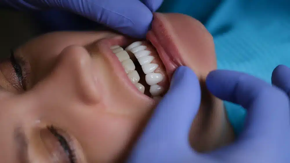 Anchorage Dental Offices Help You Choose the Right Dentures - Emerald Peak Dental