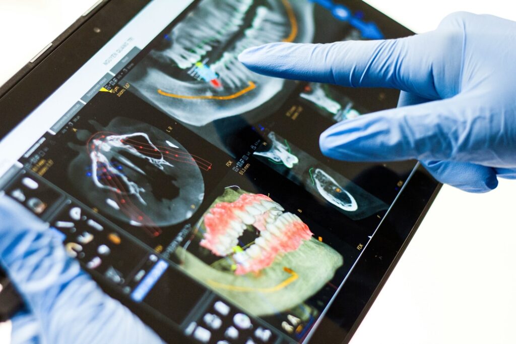 anchorage dental x rays