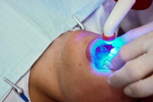 Teeth Whitening Options in Anchorage