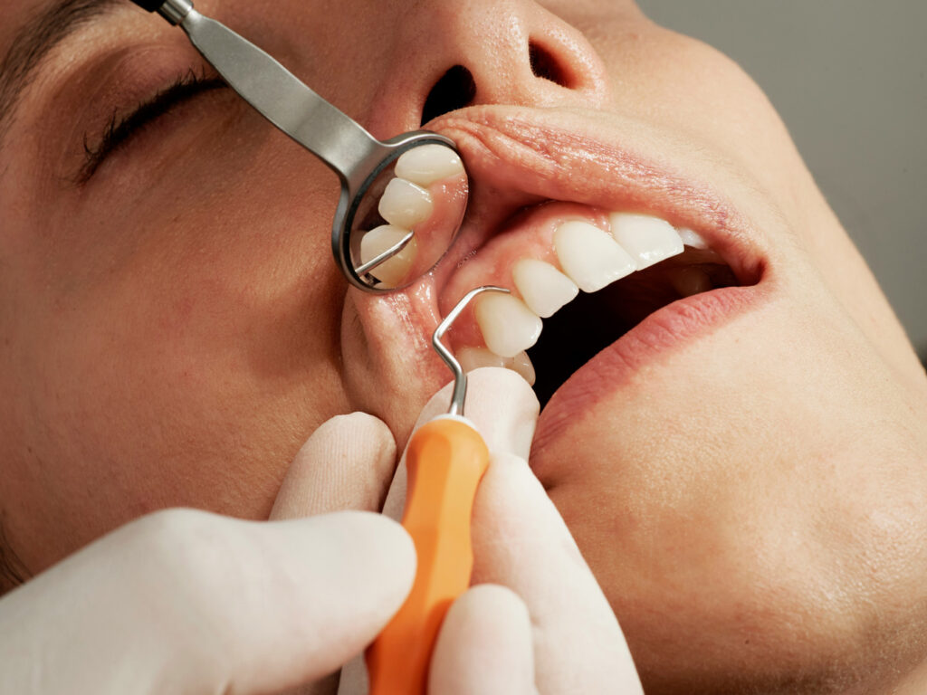 Anchorage Dentist Accepting New Patients - Emerald Peak Dental