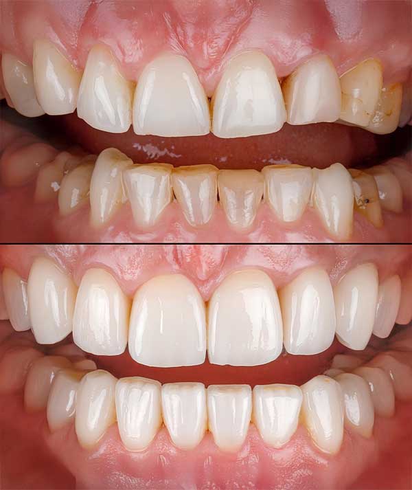 Dental Reconstruction in Anchorage