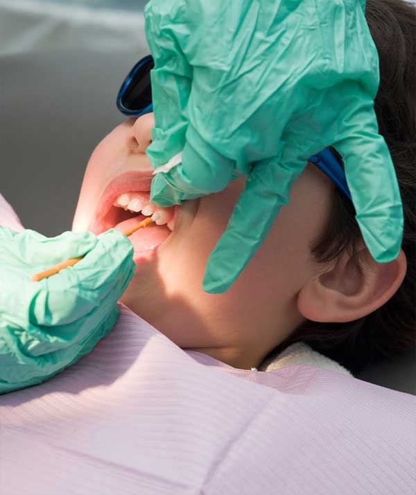 Fluoride Treatment in Anchorage