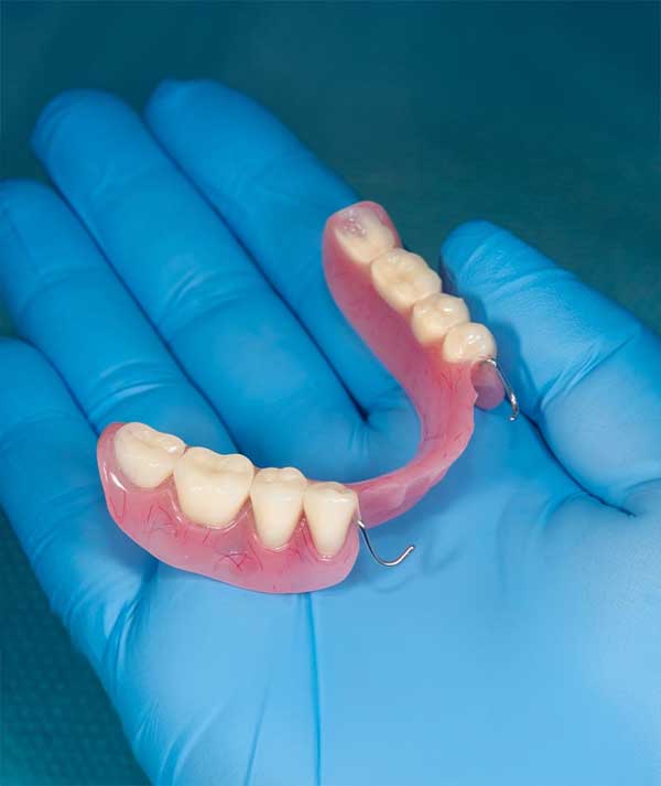 Partial Dentures in Anchorage