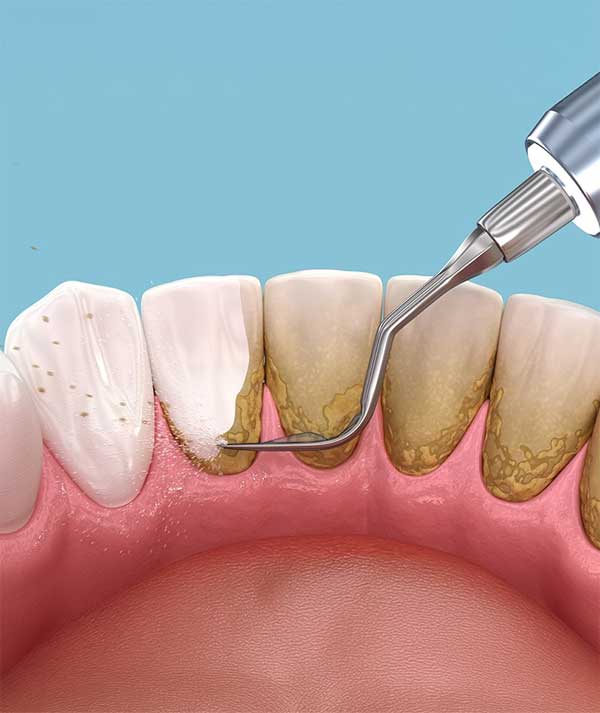 Periodontist in Anchorage