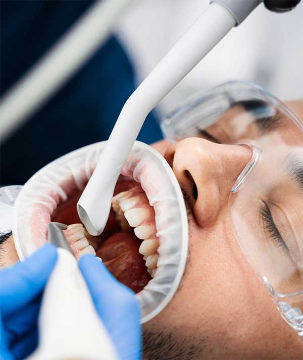 Professional Teeth Cleaning in Anchorage