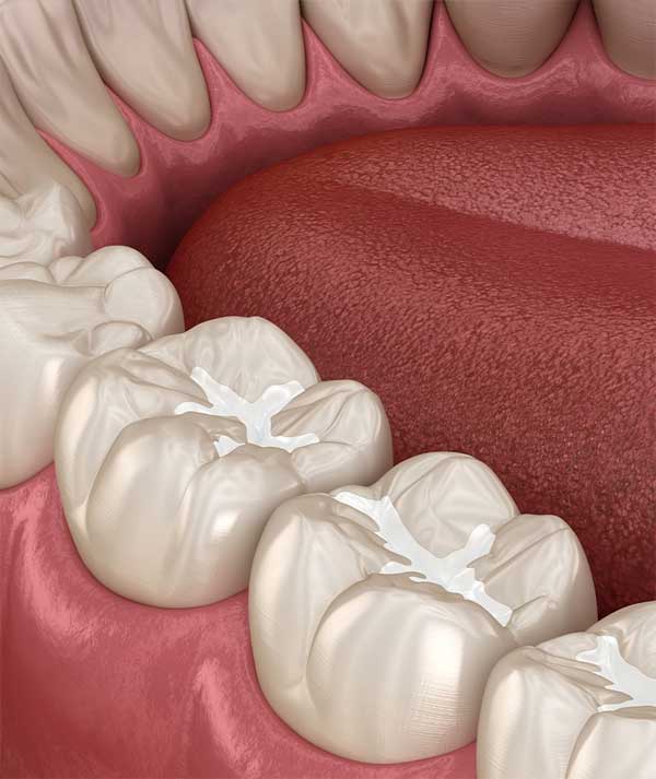 Sealants in Anchorage