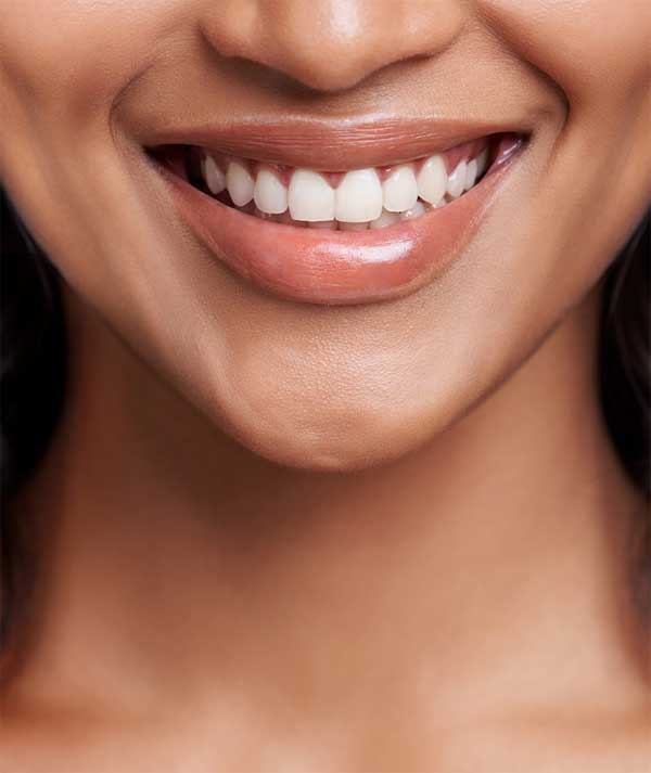 Teeth Whitening in Anchorage